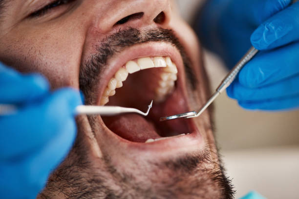 Oral Surgery in Villa Park, CA